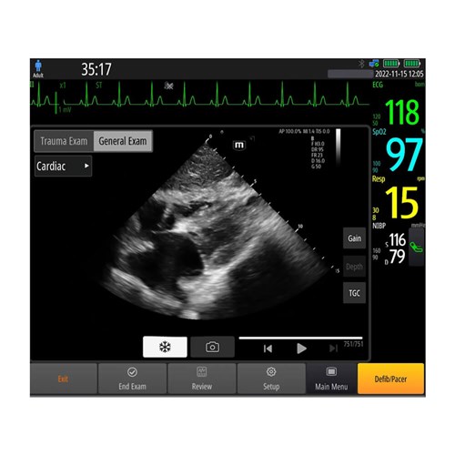 610165-mindray-beneheart-d60-defibrillator-monitor-4