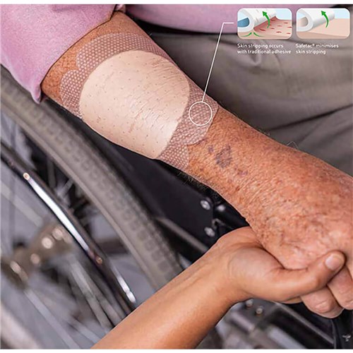 WEB-2300-mepilex-border-flex-dressing-5